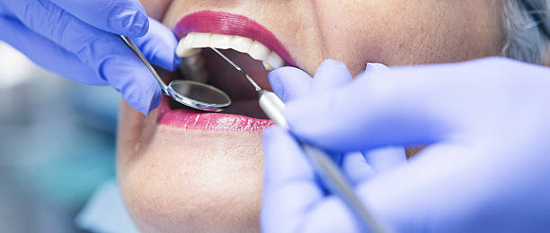 Best Emergency Dentist for Lost Fillings or Crowns in Santa Paula, CA